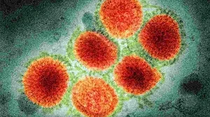 WHO reports first death from H3N8 virus in China