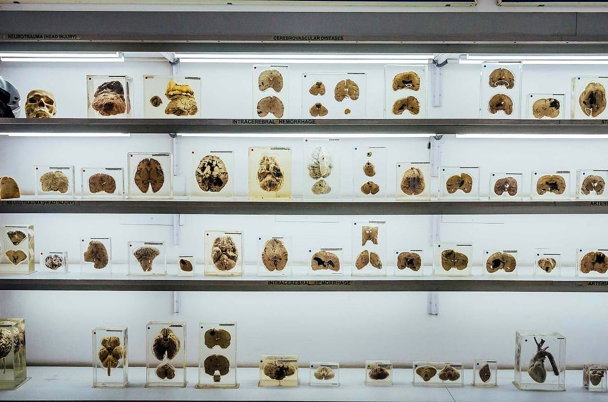 (Photo courtesy the Human Brain Museum)