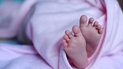 Infant branded with hot iron rod to cure respiratory problem dies in MP