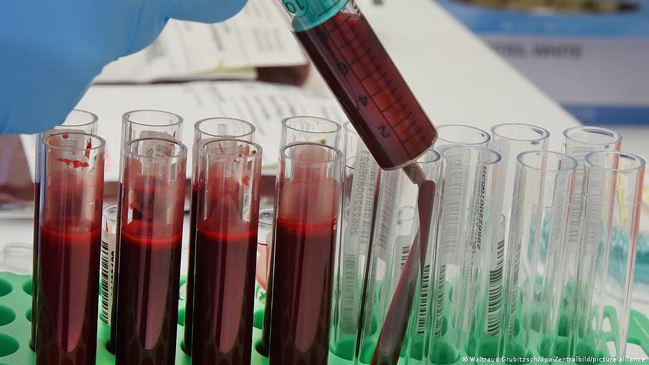 New blood tests can help detect ovarian cancer early (photo: DW)