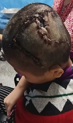 Rosa's daughter-in-law is currently undergoing treatment in AIIMS, New Delhi. She has undergone multiple surgeries in the past week (photo courtesy Sudeshna Banerjee)