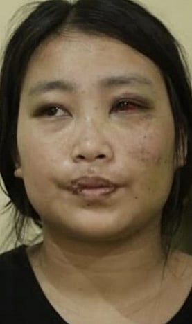 Taliah,* a nursing student in Imphal (photo courtesy Sudeshna Banerjee)