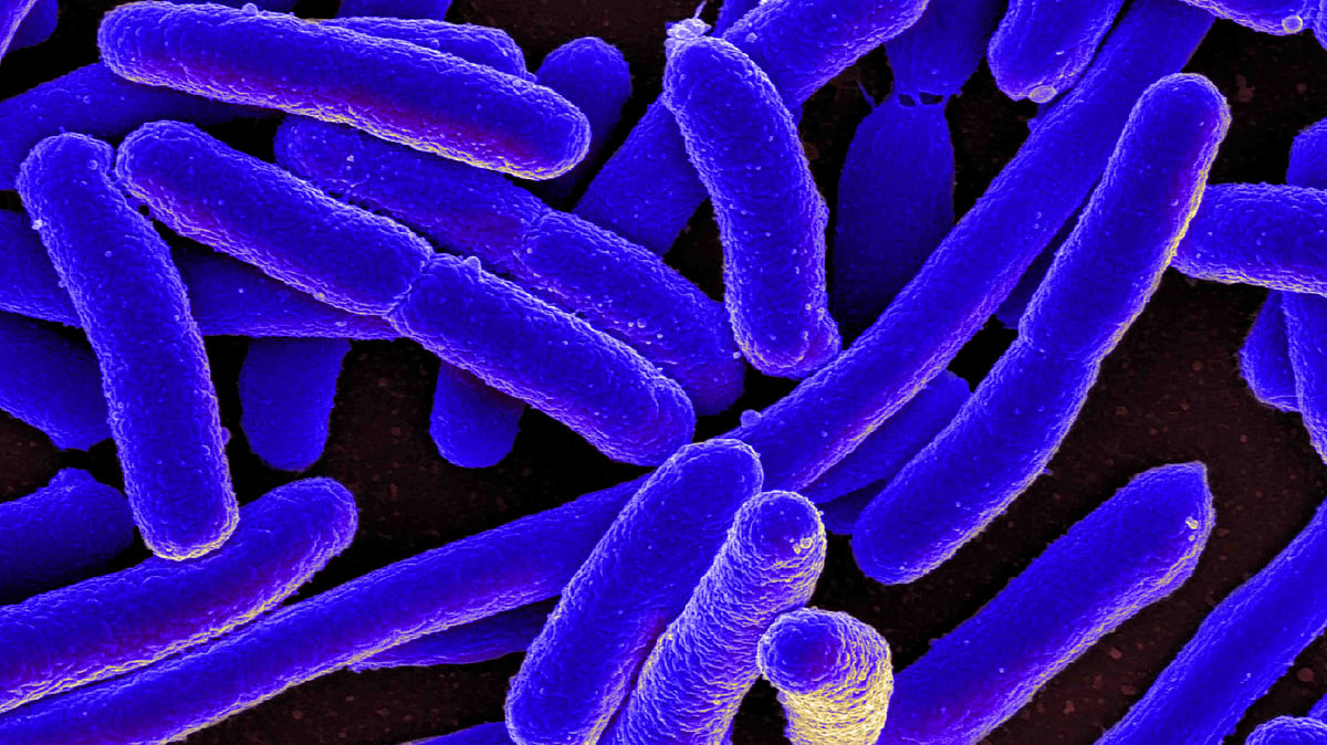 US woman loses all 4 limbs due to bacterial infection from fish