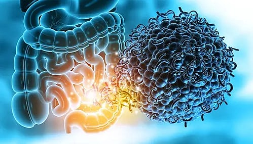 Study shows our gut microbes may determine bone health