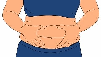 Representative image of obesity