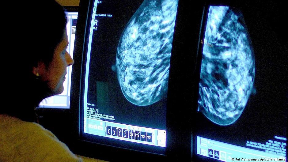 New findings show promise in enhancing head and neck cancer treatment with fewer radiation sessions (representative image) (photo: National Herald archives)