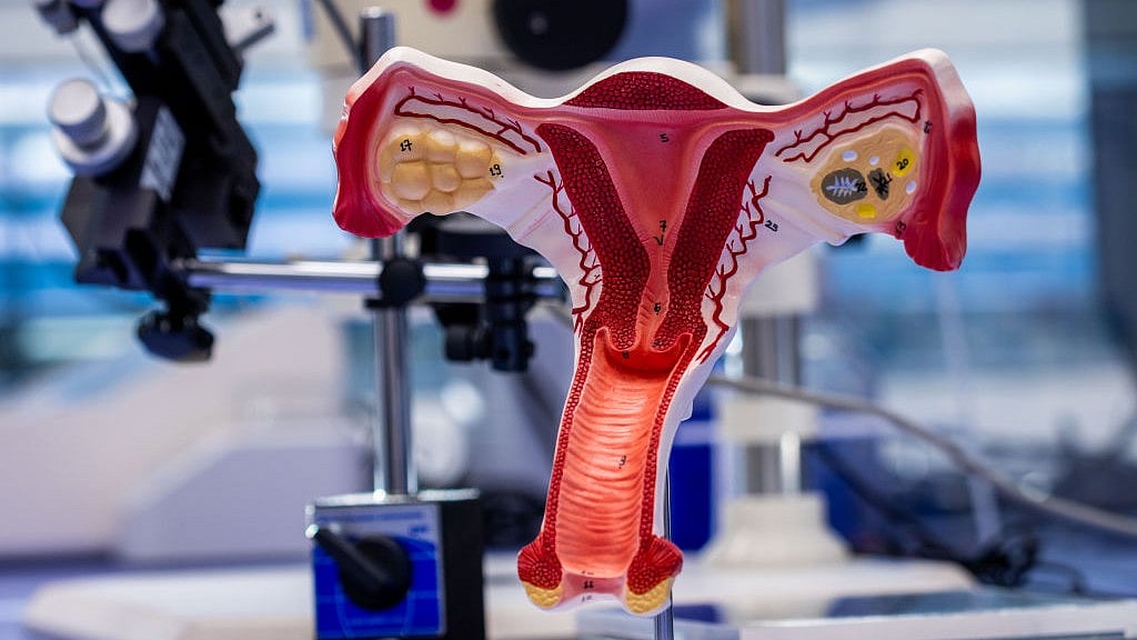 Representative image of a uterus model  (Photo: Jens Büttner/picture alliance via Getty Images)