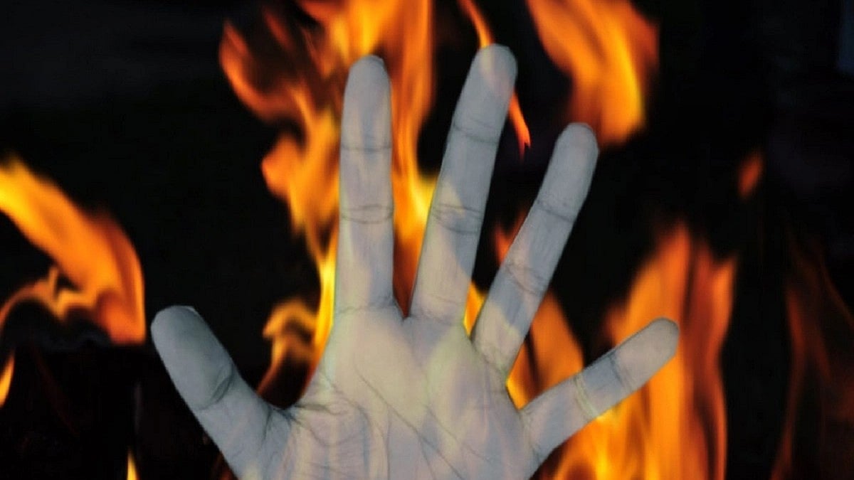 Class 10 Aligarh student set on fire over bag dispute