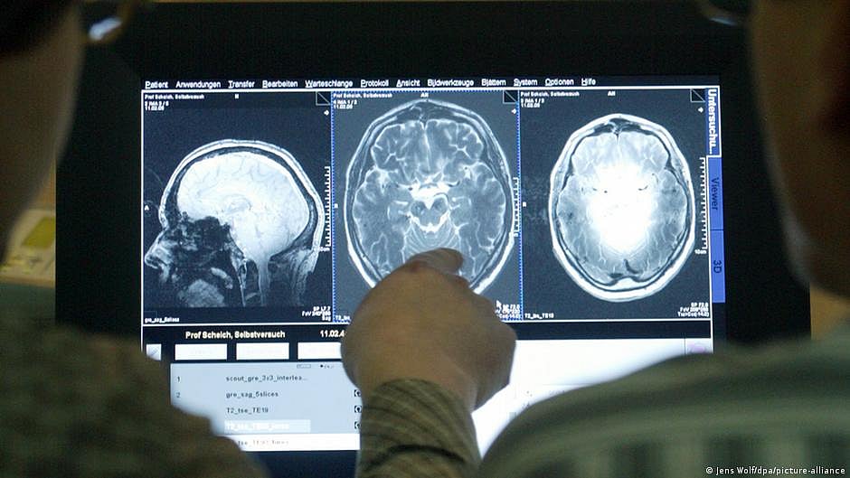 Representative image of a brain scan (photo: DW)