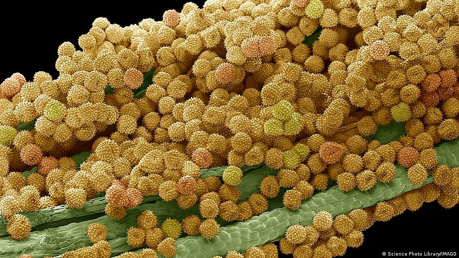 Can we treat autoimmune disease with 'inverse' vaccines?