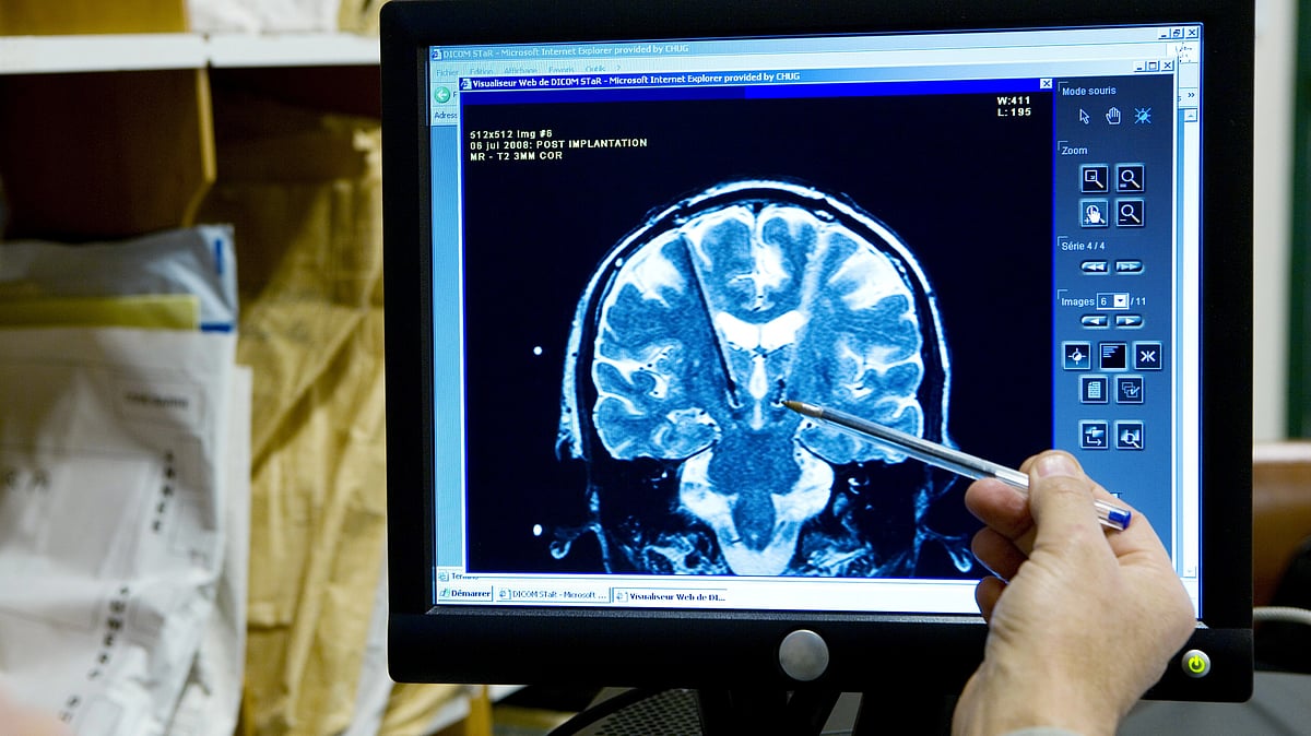 Our brain can't 'rewire' itself, say neuroscientists