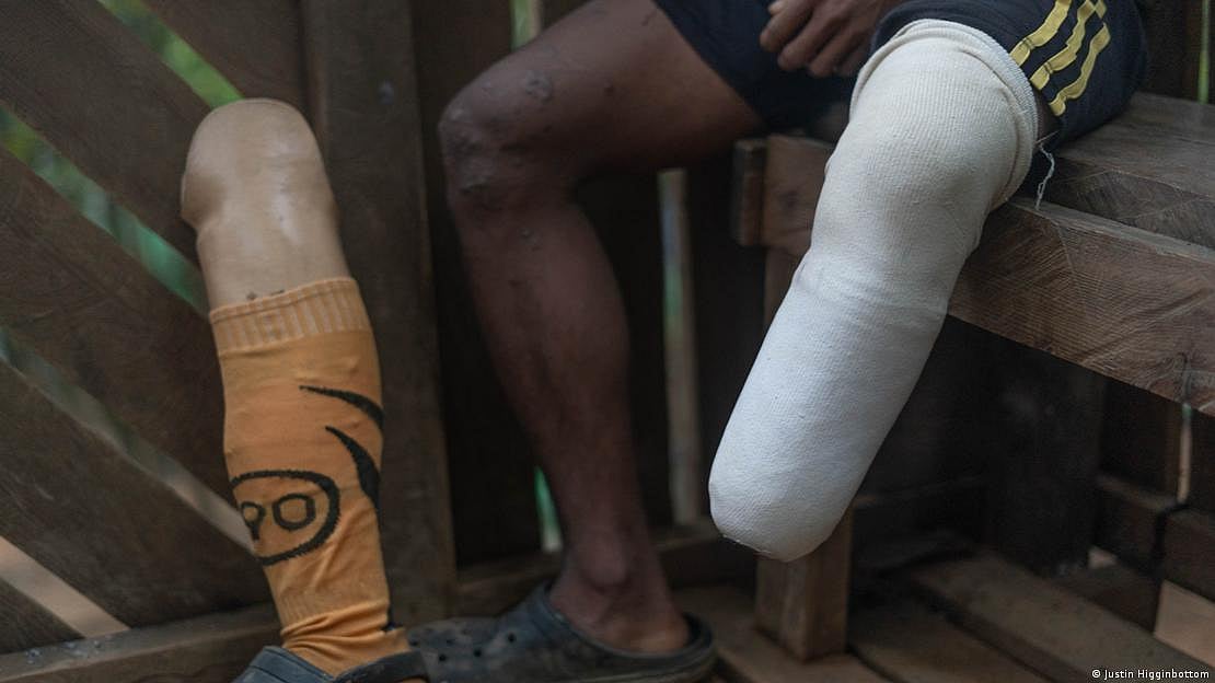 Injuries are an integral part of the fight against the junta (photo: DW)