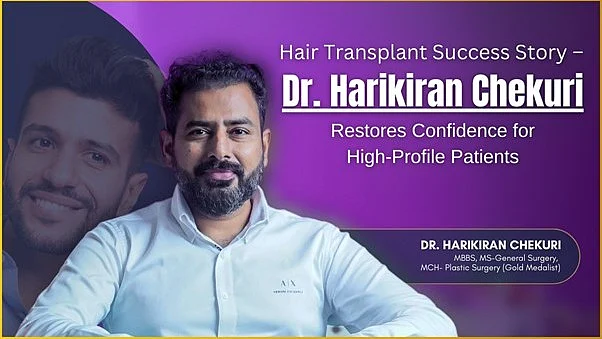 Hair transplant success story – Dr Harikiran Chekuri