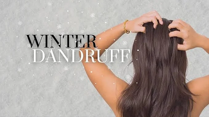 Winter dandruff — an unwelcome and too-frequent guest