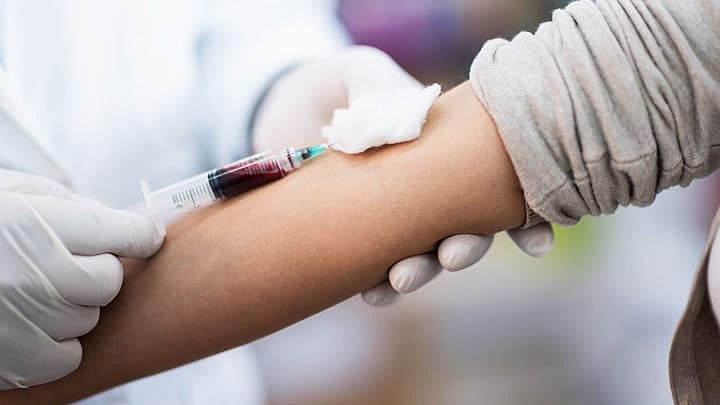 How to prepare for a blood test