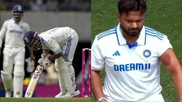 Rishabh Pant after taking the body blows during his innings in Sydney