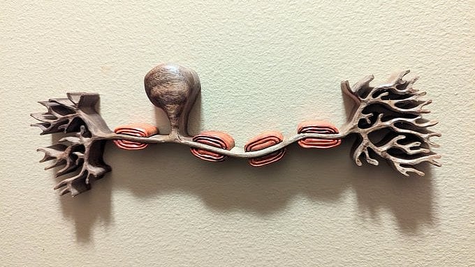 Model of a nerve cell shows clumps of myelin cushioning the neuron