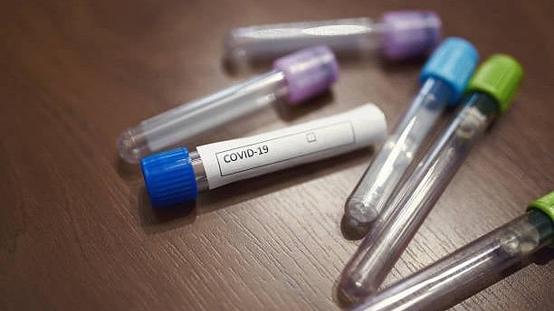Gujarat reports 167 new Covid cases; country’s active case tally nears 5,000