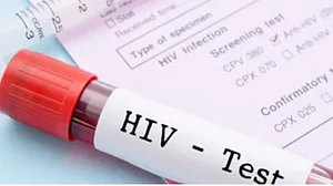 UNAIDS warns of major setbacks in global HIV response, calls for renewed solidarity