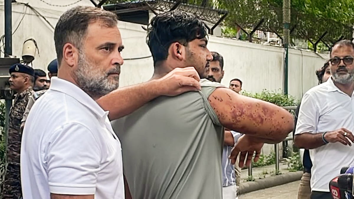 Rahul Gandhi with the victim of alleged pellet gun firing, in New Delhi