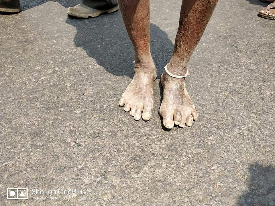 महाराष्ट्र किसान आंदोलन: तस्वीरों में देखें सड़कों पर उतरे अन्नदाता का हाल