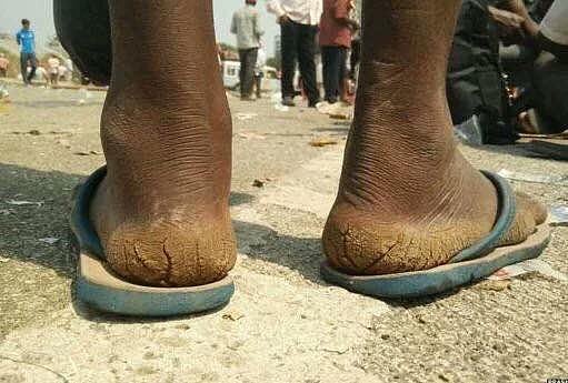 फोटो सोशल मीडिया