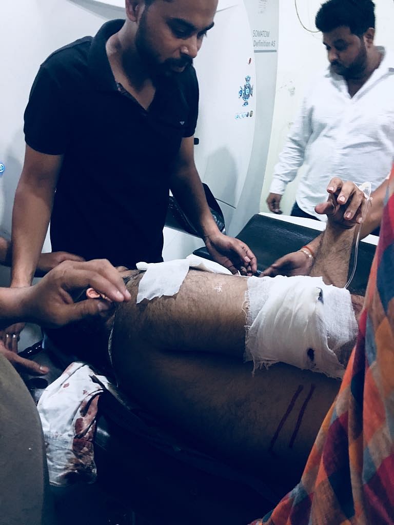 डॉ कफील के भाई पर गोरखनाथ मंदिर के पास जानलेवा हमला, तीन गोलियां लगीं, हालत गंभीर