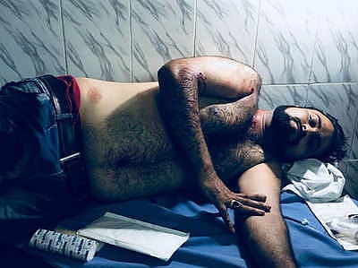 डॉ कफील के भाई पर गोरखनाथ मंदिर के पास जानलेवा हमला, तीन गोलियां लगीं, हालत गंभीर