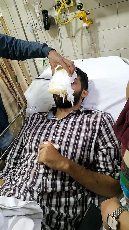 जामिया के बाद अलीगढ़ में लाठीचार्ज, दिल्ली पुलिस HQ पर प्रदर्शन, विपक्ष ने केंद्र को जिम्मेदार ठहराया