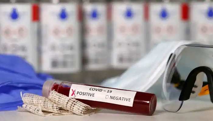 यूपी में कोरोना का कहर! लखनऊ सीएमओ कार्यालय सील, अकाउंटेंट हुआ पॉजिटिव, कई मंत्री भी चपेट में