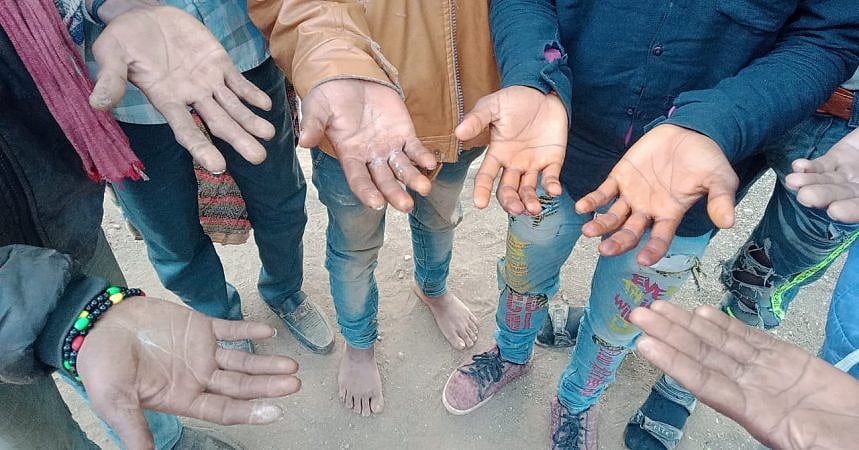 मध्य प्रदेश के गुना में बंधुआ मजदूरों के साथ अमानवीयता, शराब माफियाओं ने हाथ तक जलाए