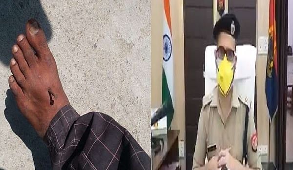 यूपी से दिल दहला देने वाली खबर! मास्क नहीं पहनने पर पुलिस ने हाथ-पैर में ठोकी कीलें, युवक ने लगाया गंभीर आरोप
