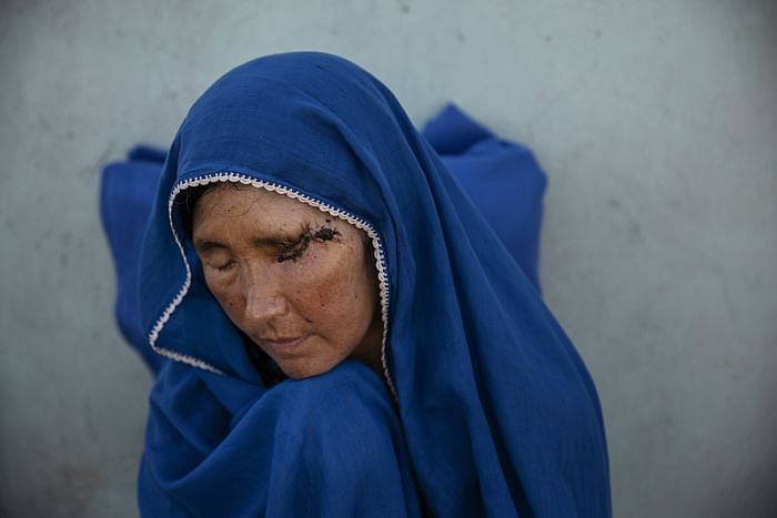 दुनिया की 5 बड़ी खबरें: खाना खराब होने पर तालिबान ने महिला को आग लगाई और निकोलस बर्न्स चीन में अमेरिकी राजजूत बने