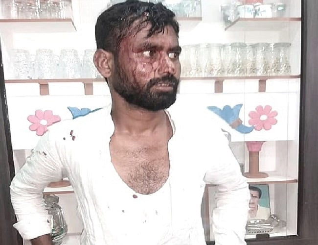 कर्नाटक चुनावः बेल्लारी ग्रामीण में मतदान के बीच झड़प, कांग्रेस नेता घायल, BJP पर गंगावती में भी बवाल करने का आरोप