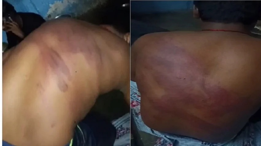 गुजरात में MP के 15 आदिवासी युवकों की बर्बर पिटाई, कमलनाथ ने अस्मिता पर हमला करार दिया