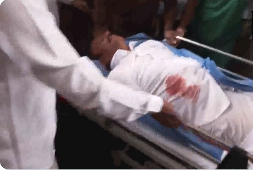 तेलंगाना चुनावः प्रचार के दौरान BRS सांसद पर चाकू से हमला, अस्पताल में भर्ती, हमलावर को समर्थकों ने पकड़ा