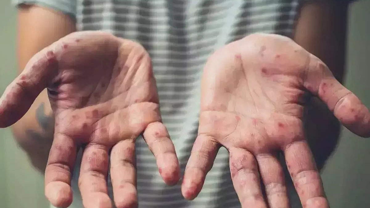 फोटो: सोशल मीडिया