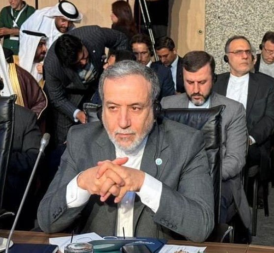 Iran-America Islamabad Talks: ईरान के विदेश मंत्री का विश्व बिरादरी से आग्रह, तय हो हमलावरों की जवाबदेही