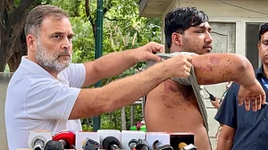 पैलेट गन से घायल युवक को लेकर राहुल ने की PC, टी-शर्ट उठाकर घाव दिखाए