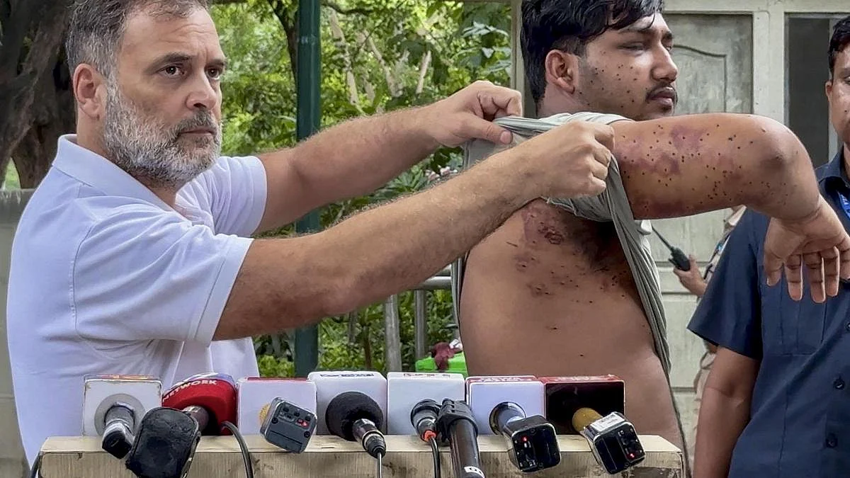 पैलेट गन से जख्मी हुए एक प्रदर्शनकारी के साथ लोकसभा में नेता विपक्ष राहुल गांधी