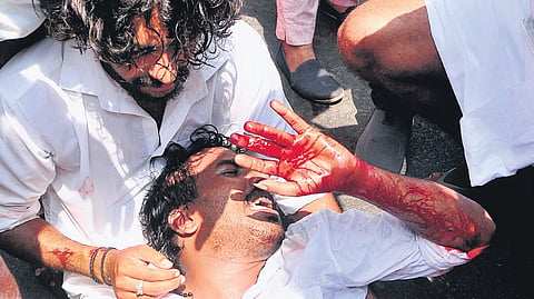 Jerin Nedumangad, KSU Thiruvananthapuram district general secretary, bleeds profusely after injuring his finger during a protest march to the Secretariat demanding a CBI probe into the death of J S Sidharthan 