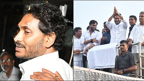 CM Jagan sustained an injury above his eyebrow. 