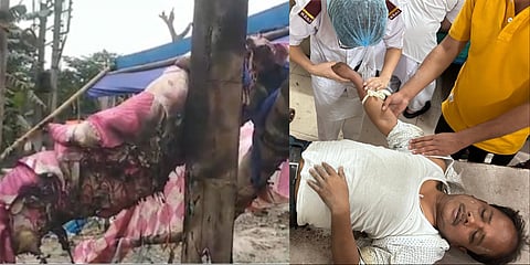 A TMC election office was torched allegedly by BJP members. (L)

TMC block president from Dinhata - I B, Anant Barman hospitalized after allegedly being beaten up by BJP members. (R) 