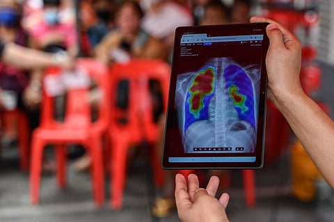 A medical worker shows an x-ray result during a tuberculosis screening.