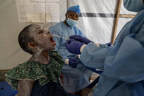 A health worker takes a saliva sample from Lucie Habimana, 13, a mpox patient, at a treatment centre in Munigi, eastern Congo, Friday, Aug 16, 2024.