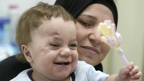 Ten-month-old Palestinian infant Mostafa Qadoura, who has already lost his eye and his immediate family to the horrors of Israel's war against Hamas in Gaza, plays with his grandmother Amna Abd Rabou, at the New Administrative Capital Hospital, just outside Cairo, Egypt on Aug 14, 2024.