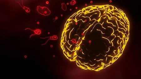 amoebic meningoencephalitis