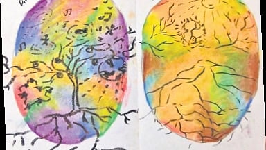 Healing with art