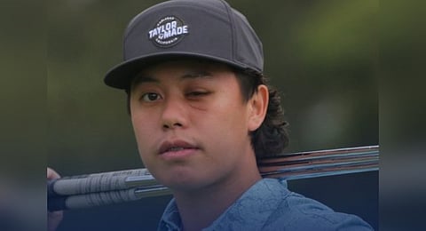 Australian rising golf star Jeffrey Guan  