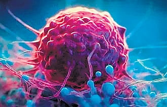 The initial phase will prioritise women, who often face societal and economic barriers that limit access to early cancer detection.
